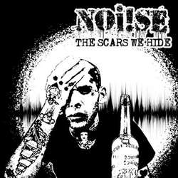 NOI!SE - The Scars We Hide CD